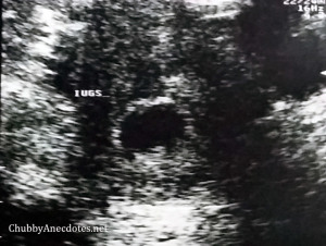 Peanut's First Ultrasound